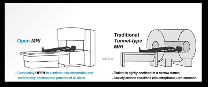 Open MRI versus Traditional Tunnel-type MRI comparison diagram